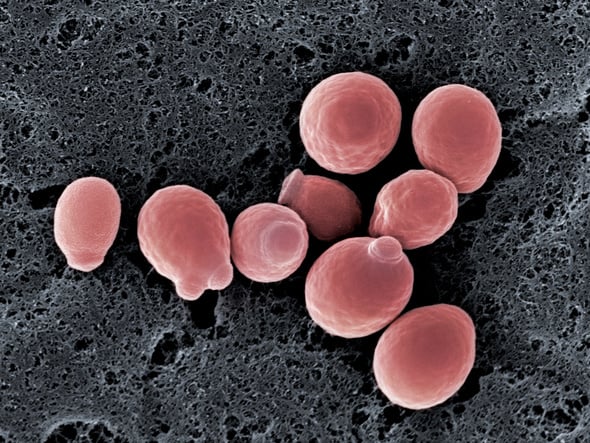 Yeast cells (Candida albicans), SEM